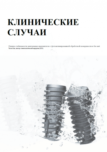 Клиническая статья. Долгосрочная стабильность имплантатов за счет UV-активации