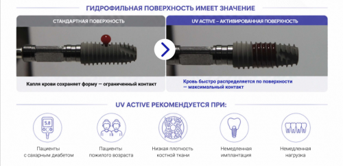 UV имплантаты при сахарном диабете